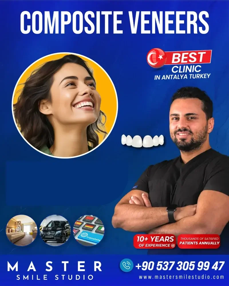 KOMPOZİT VENEER